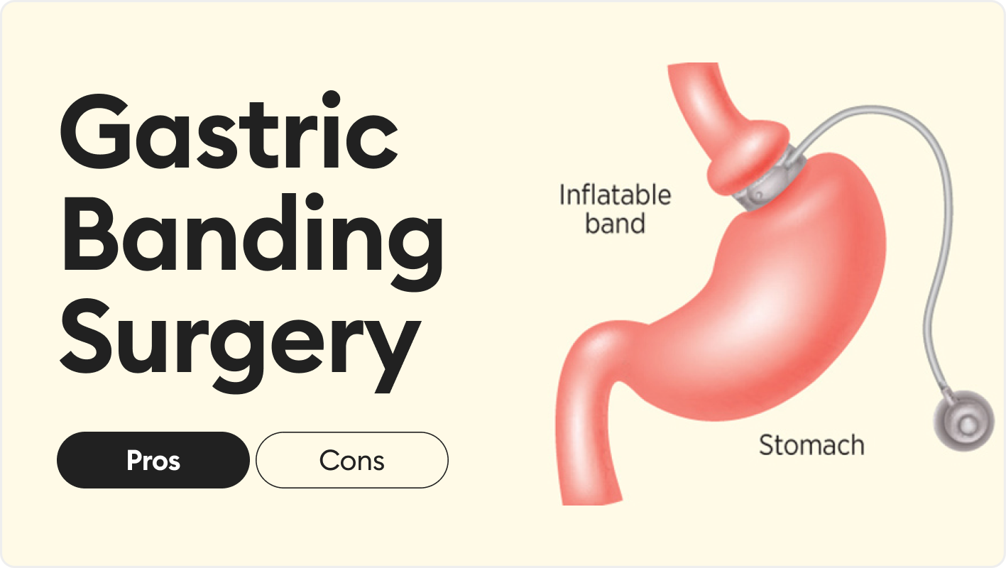 gastric banding surgery pros and cons